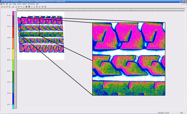 Zoom View Feature